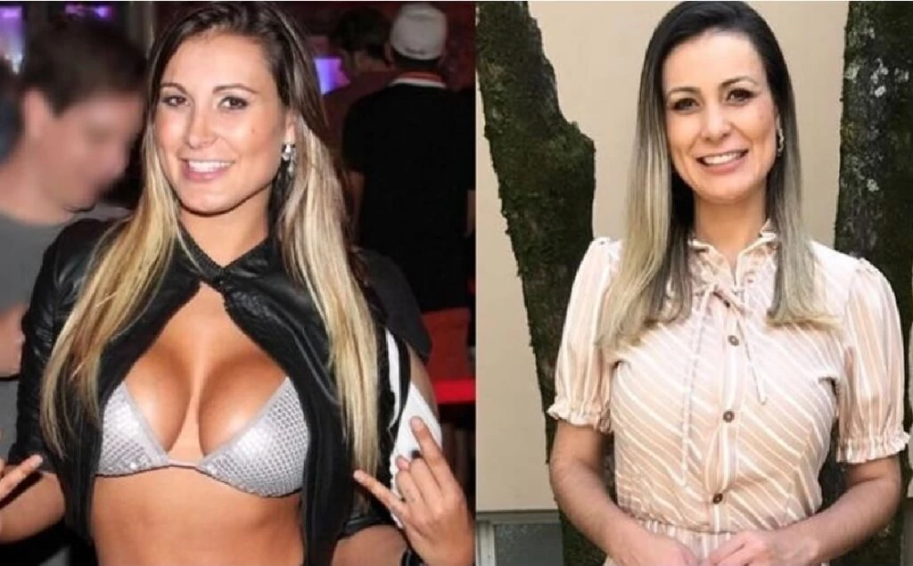 Andressa Urach posta foto do seu antes e depois e assusta internet